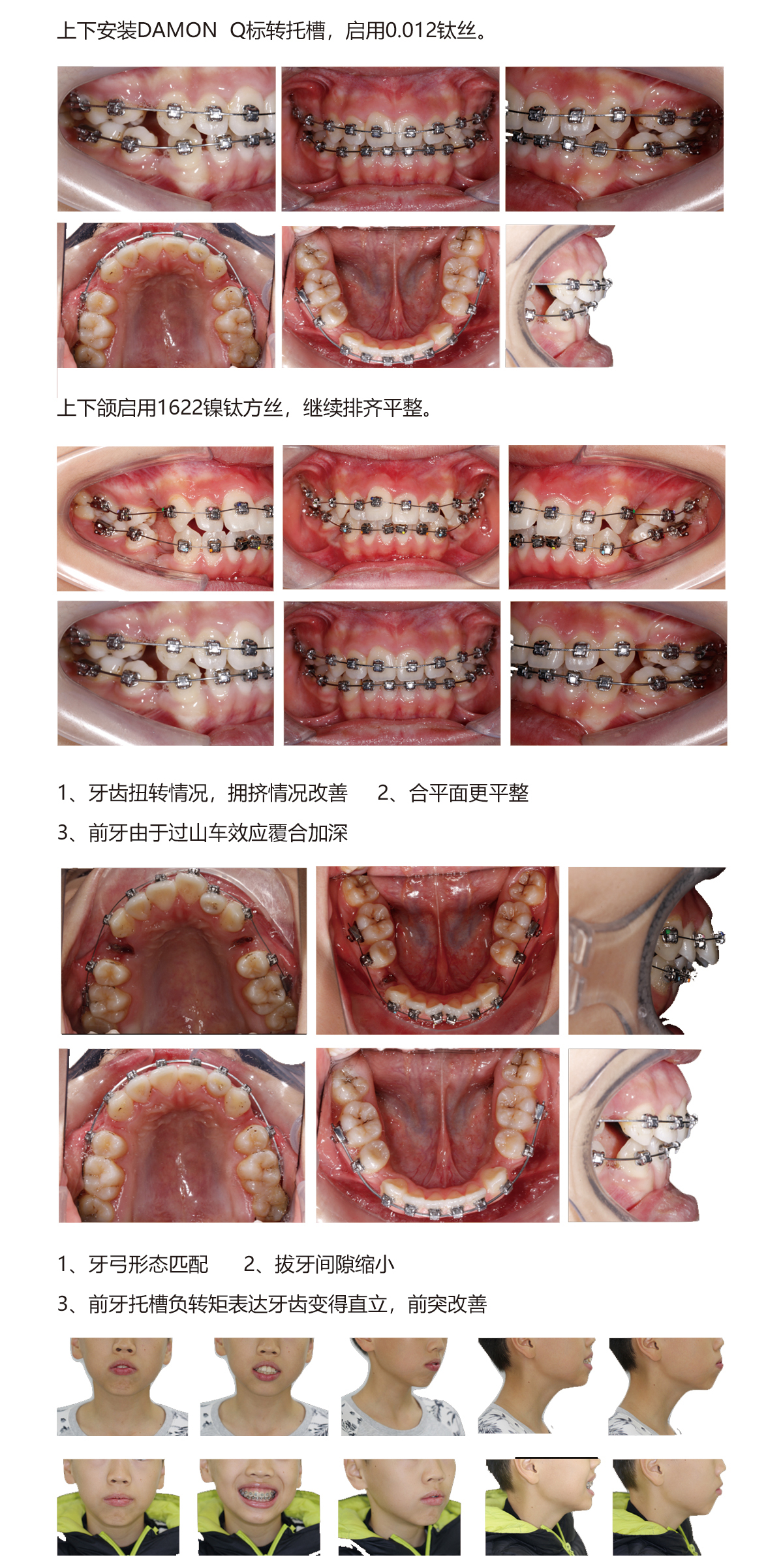 郑秀文病例3.jpg
