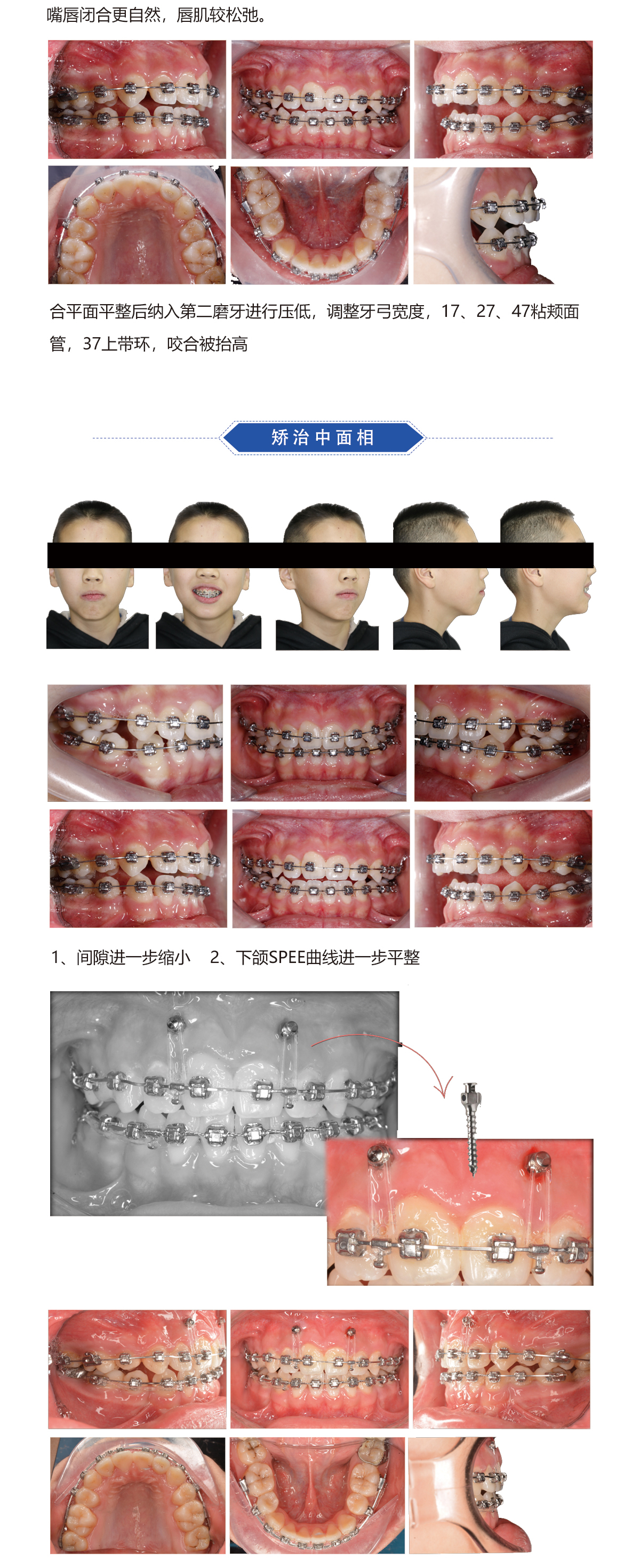 郑秀文病例4.jpg