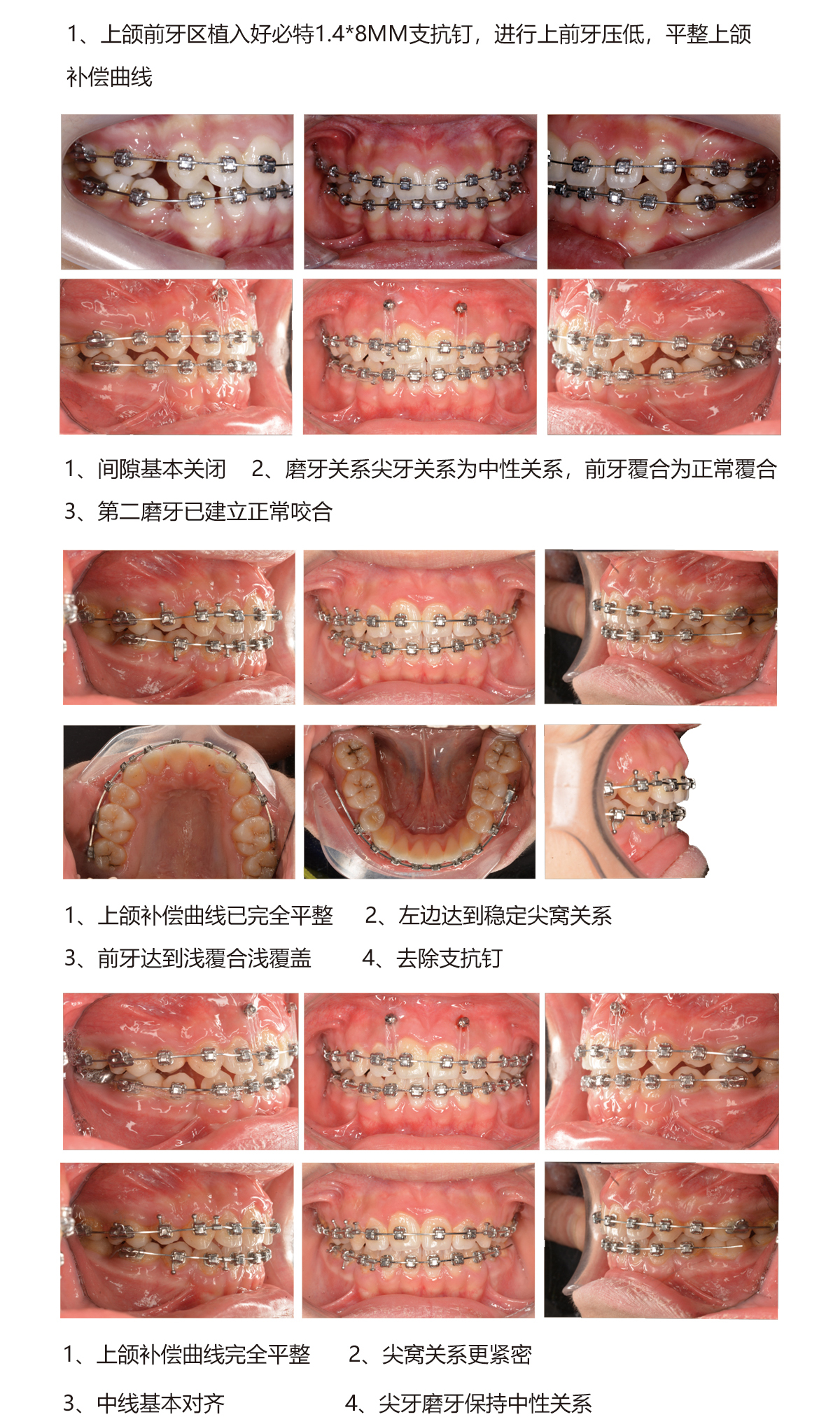 郑秀文病例5.jpg