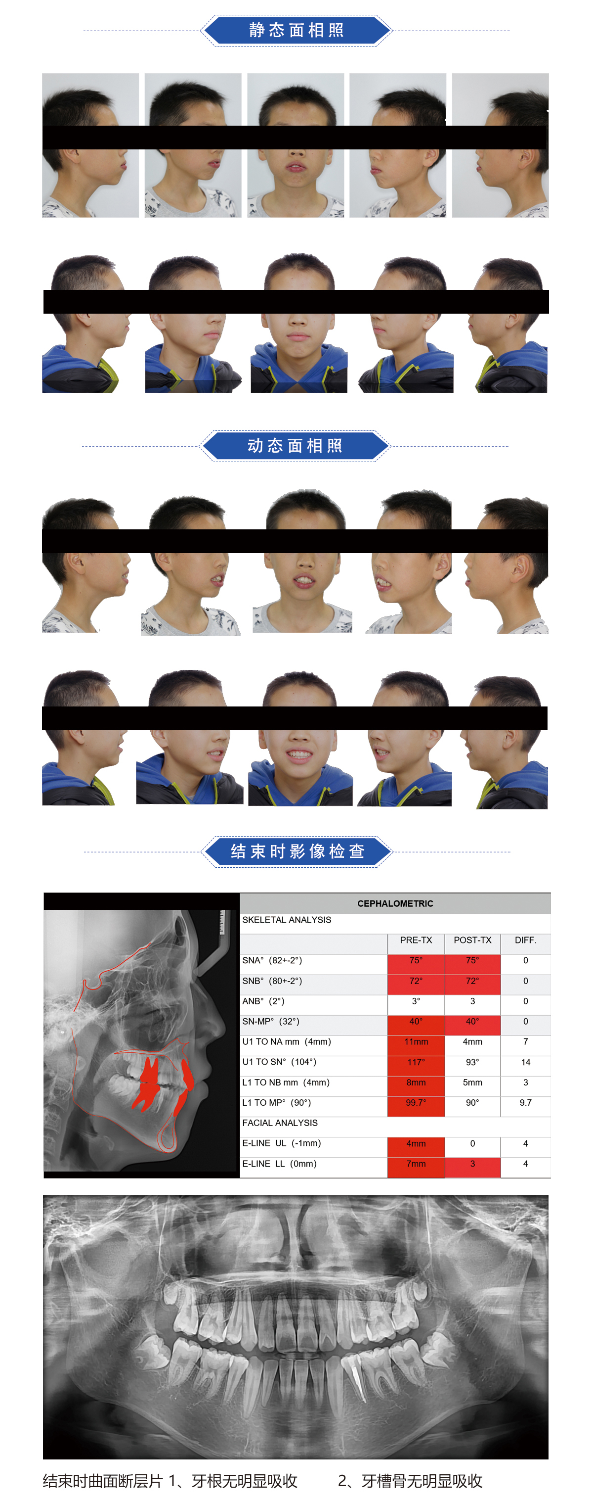 郑秀文病例7.jpg