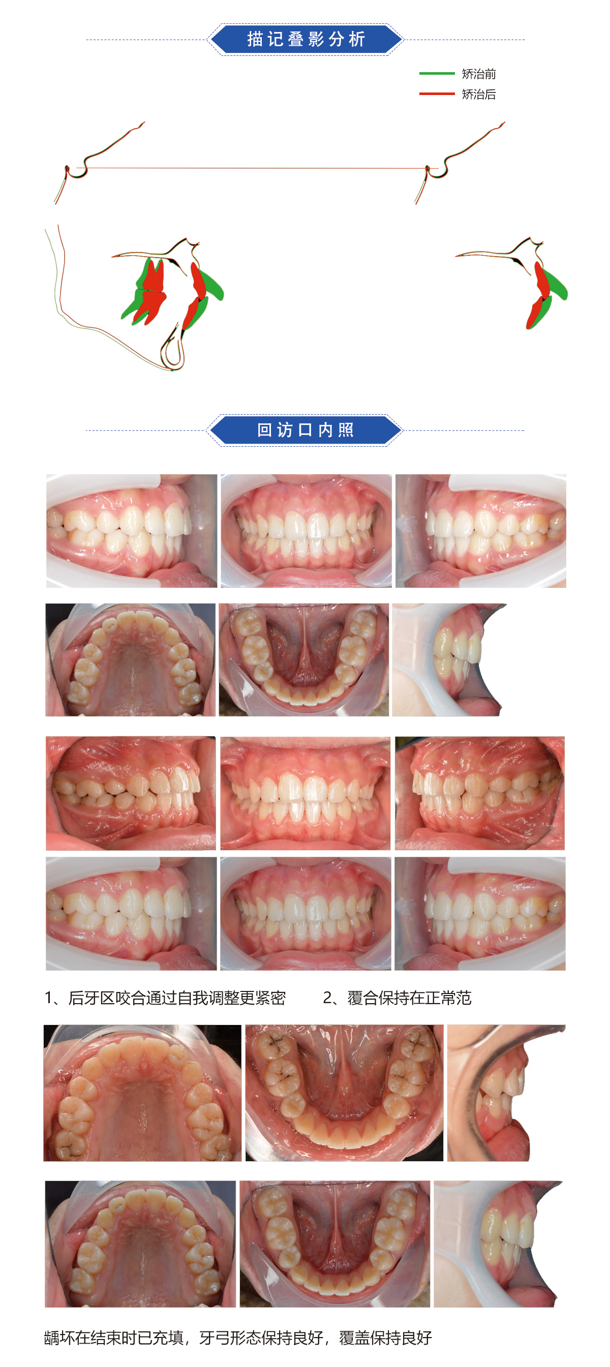 郑秀文病例8.jpg