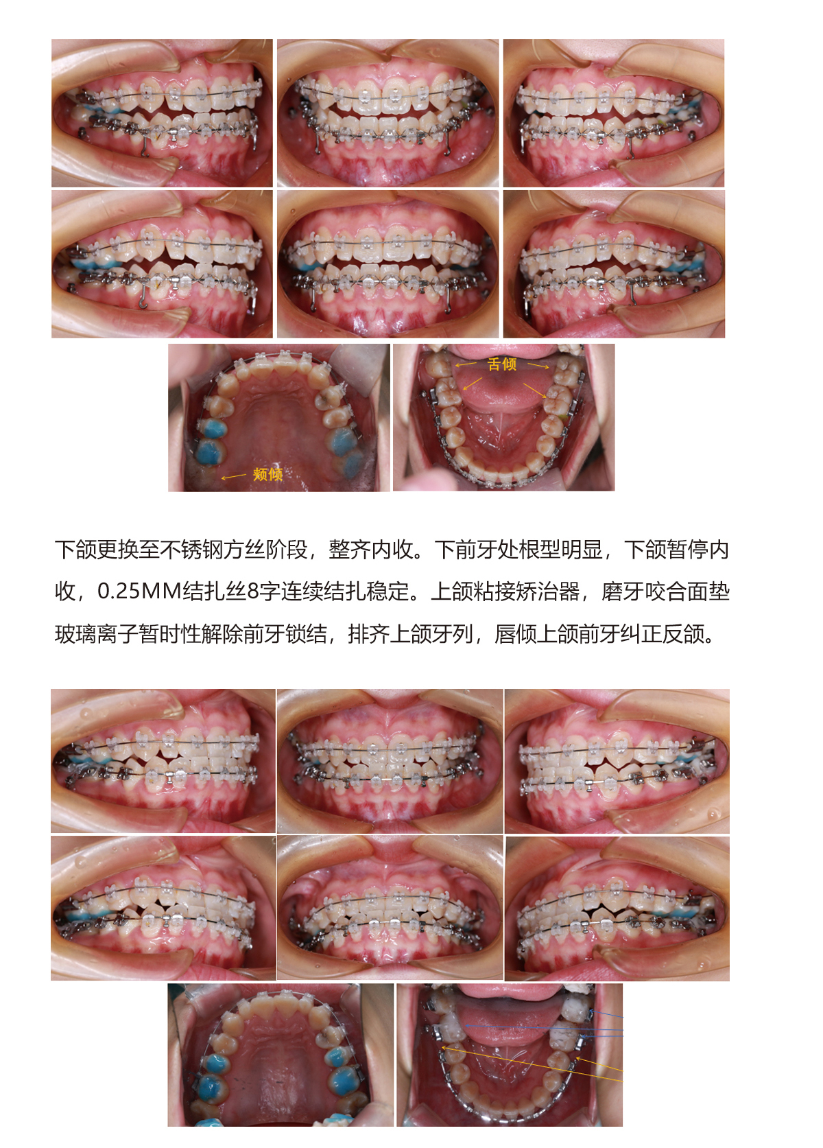陈军病例3（2）.jpg