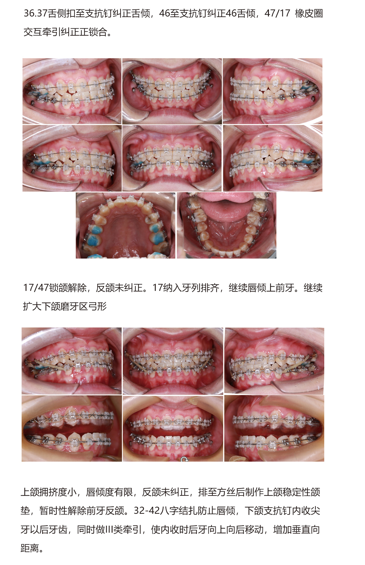 陈军病例4（1）.jpg