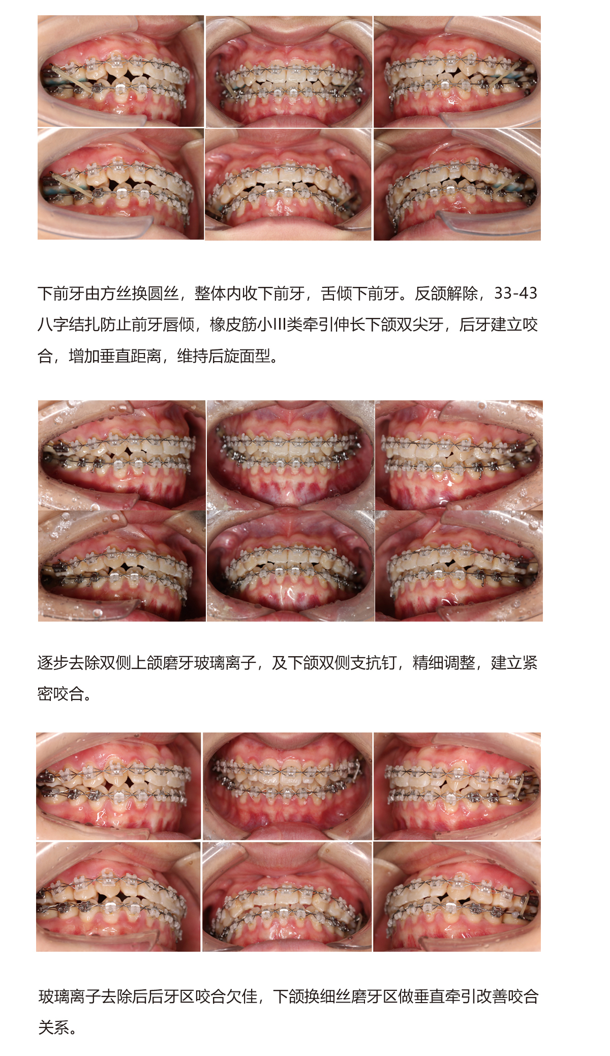 陈军病例4（2）.jpg