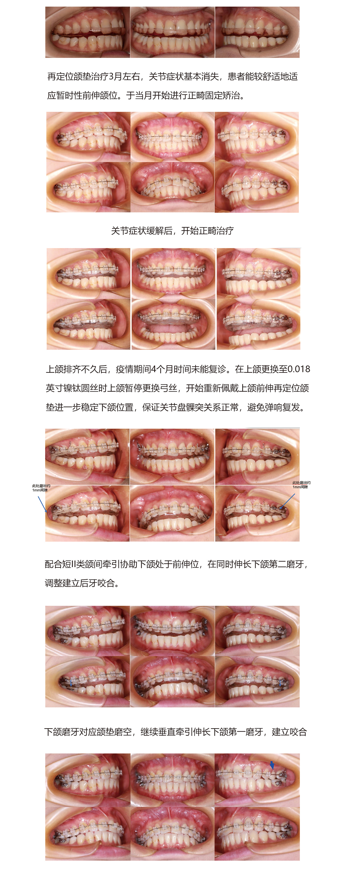陈军32病例（22）.jpg