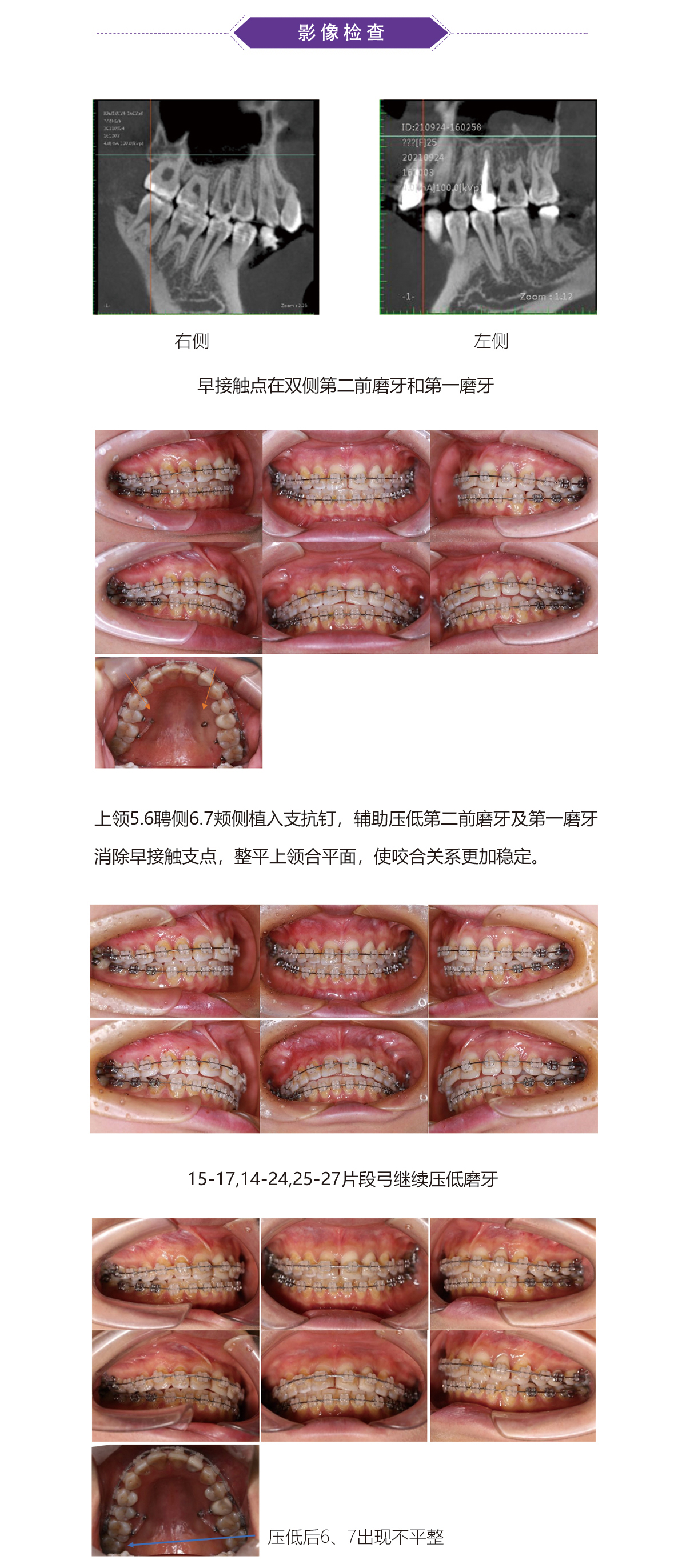 陈军32病例（41）.jpg