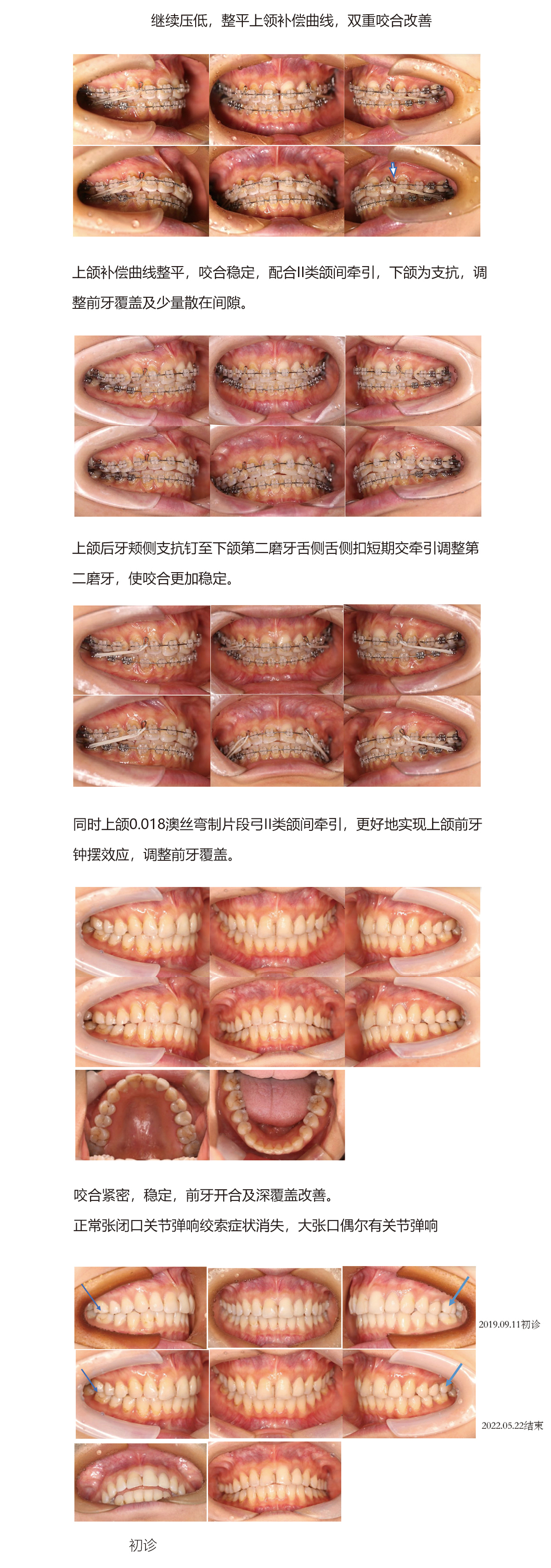 陈军32病例（42）.jpg
