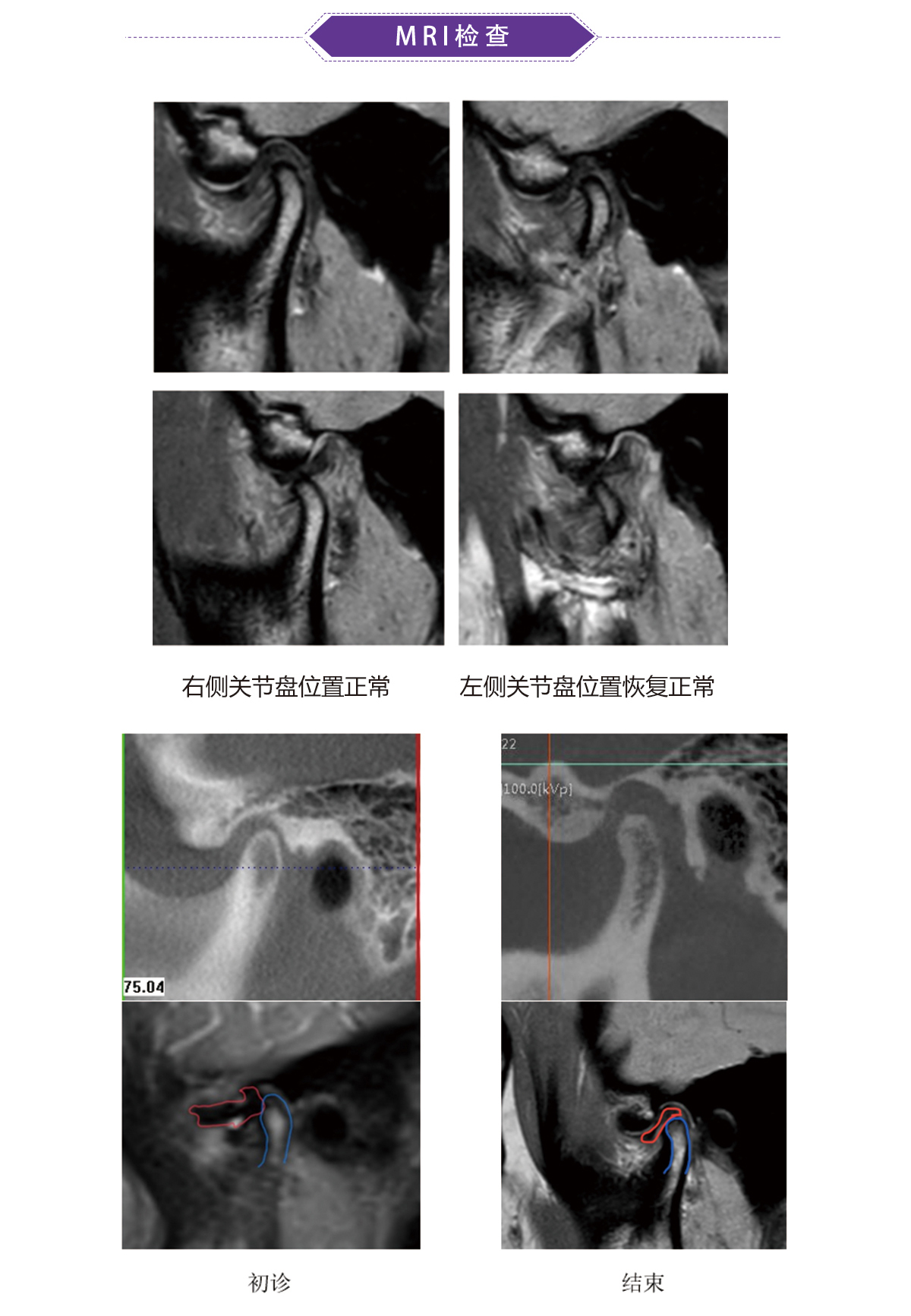 陈军32病例（61）.jpg