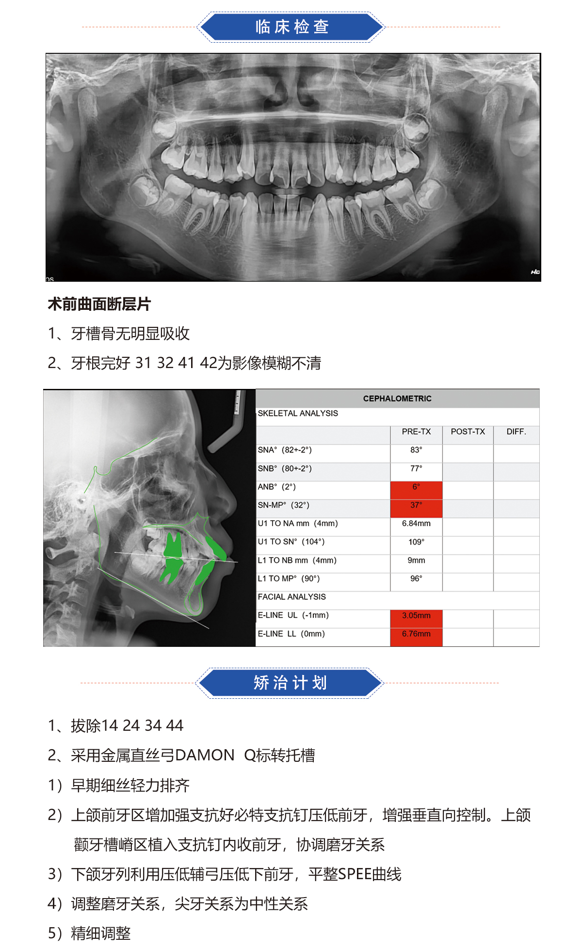 赖思彤2.jpg