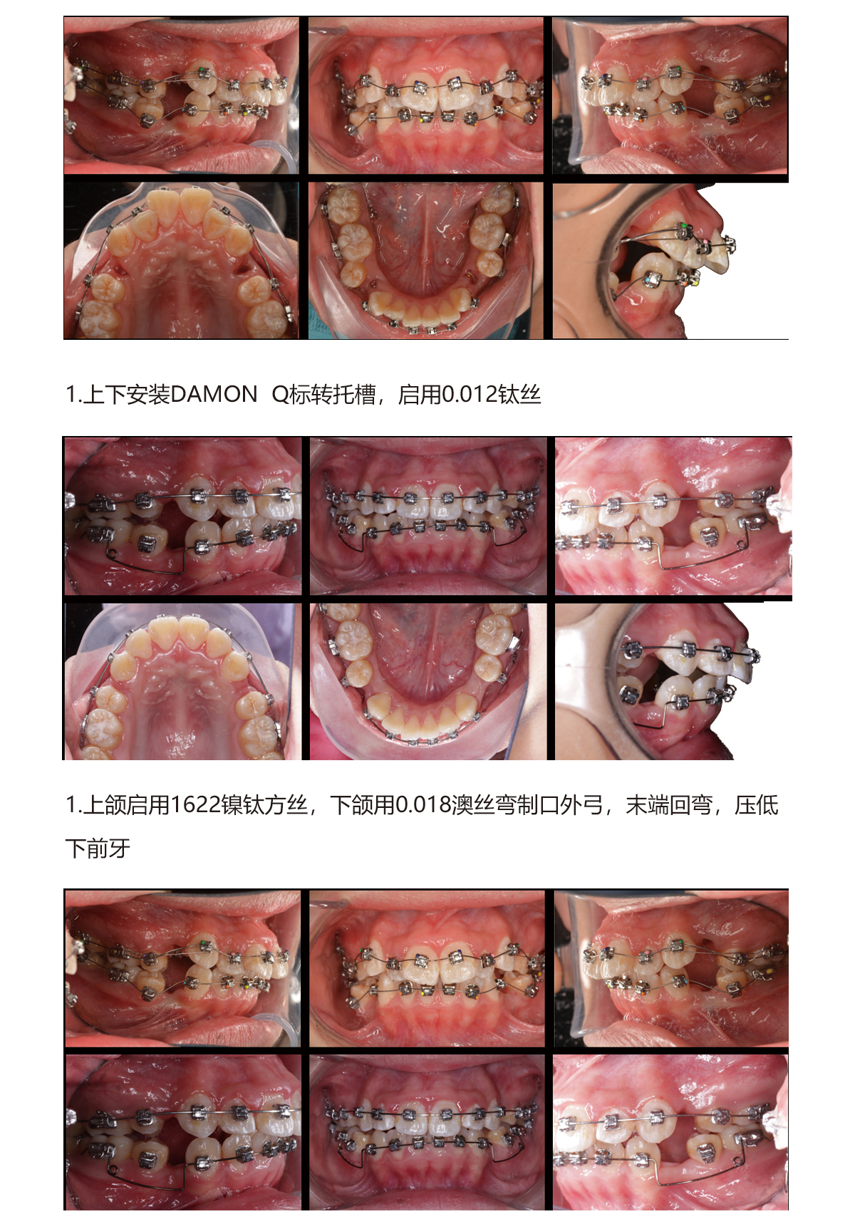 赖思彤3.jpg