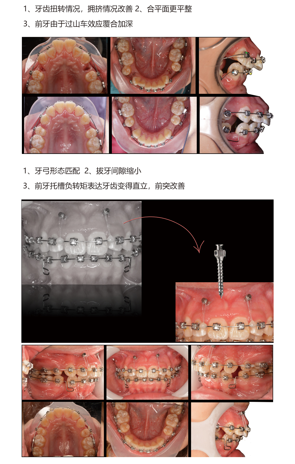 赖思彤4.jpg