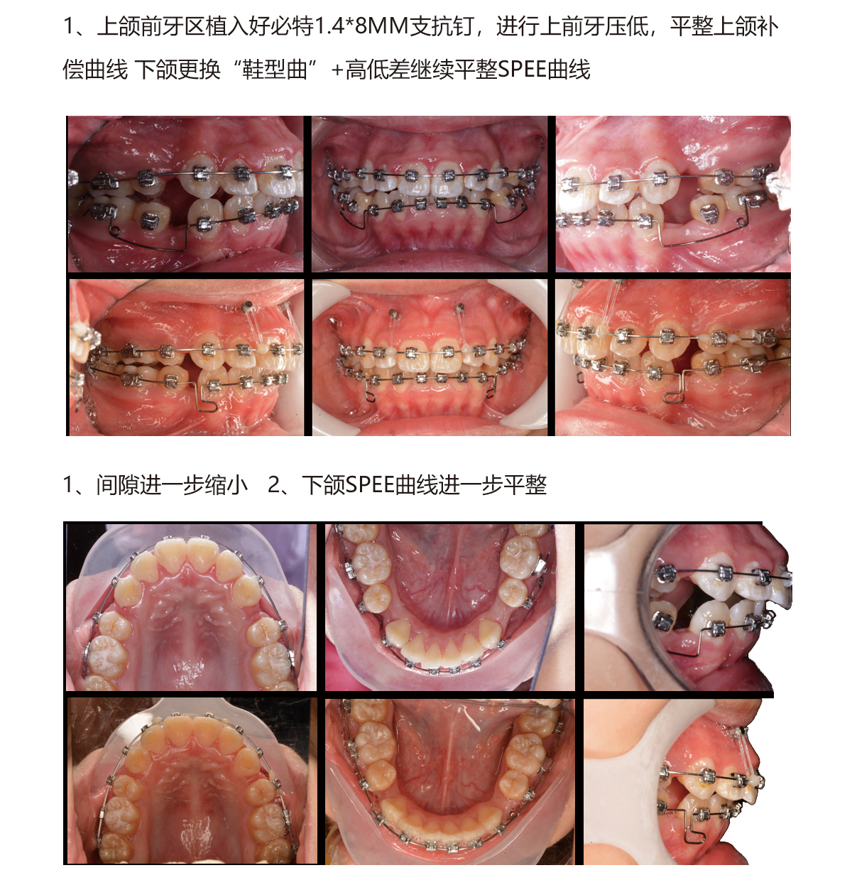 赖思彤5.jpg
