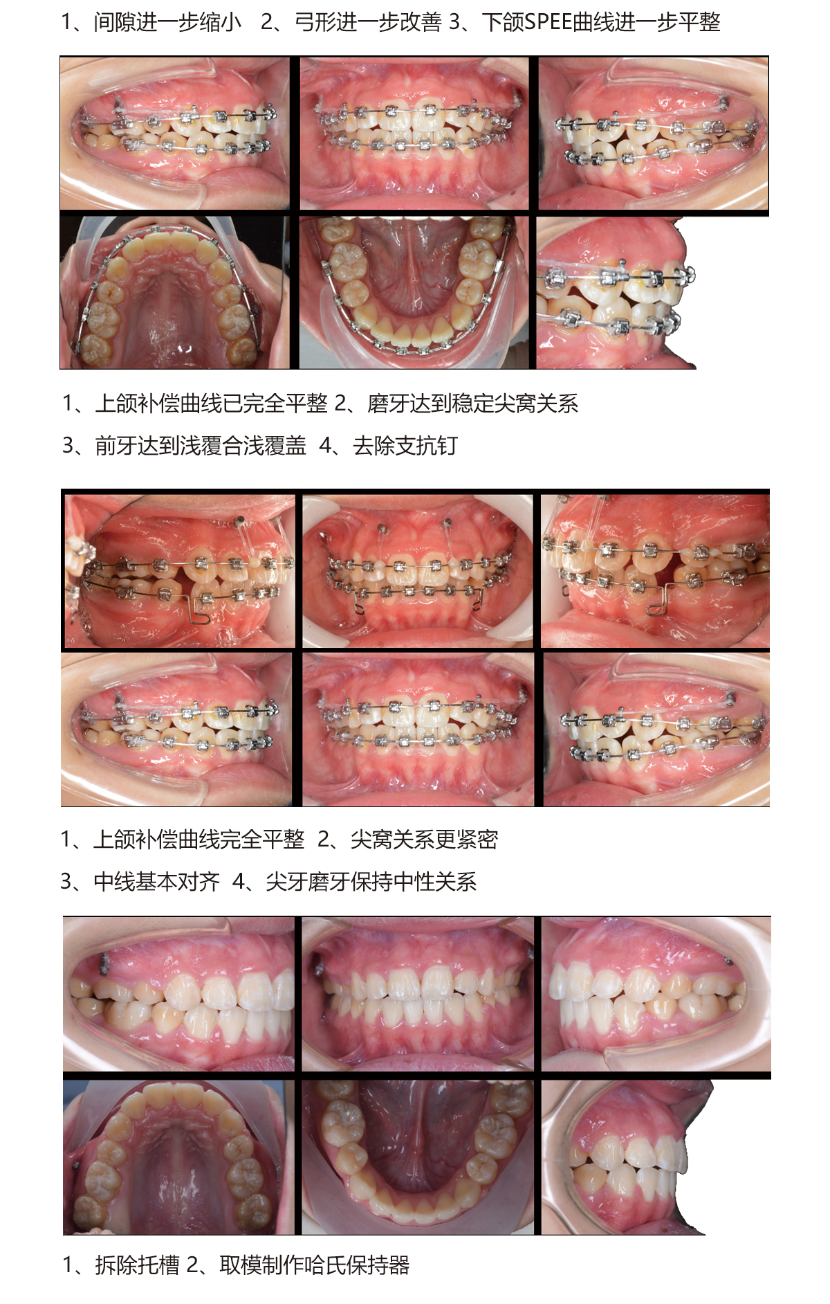 赖思彤6.jpg