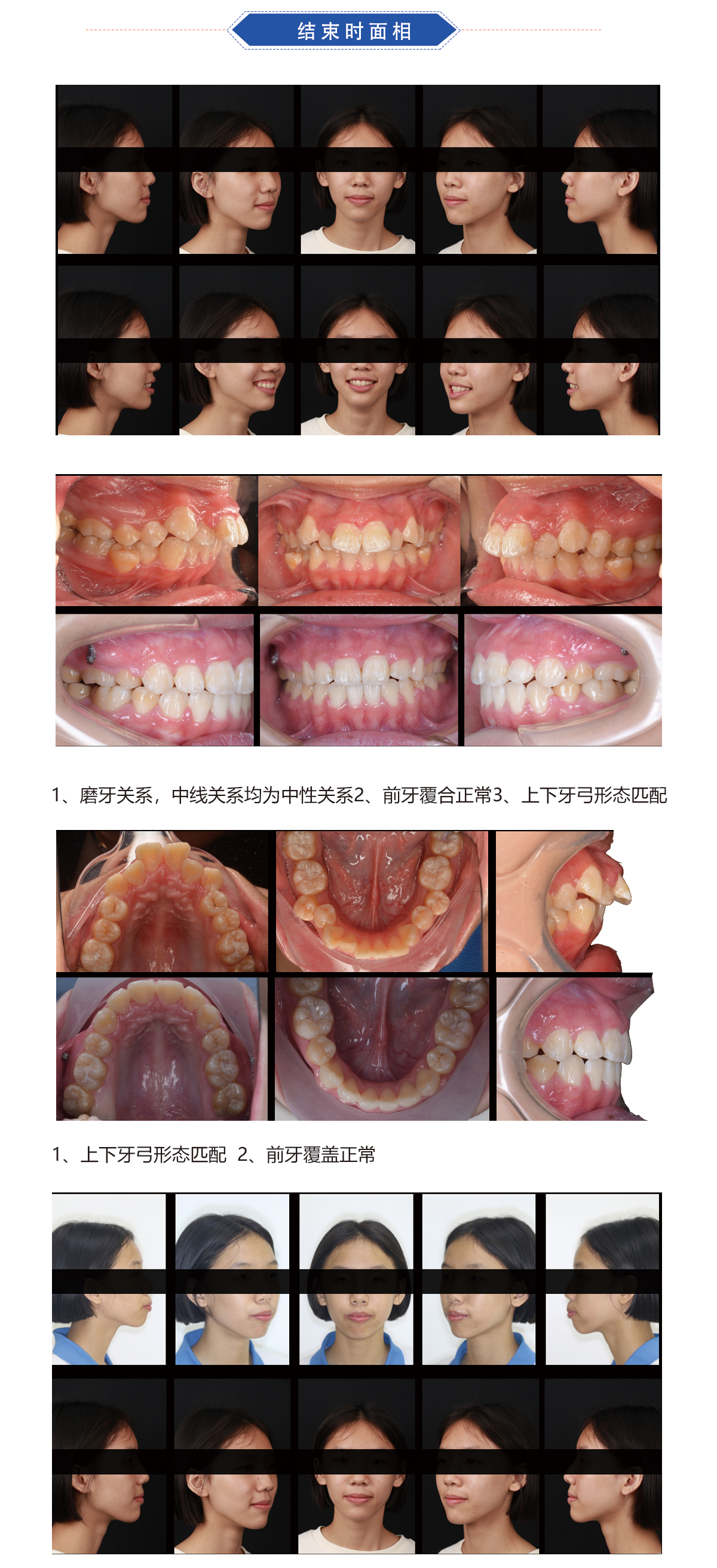 赖思彤7.jpg